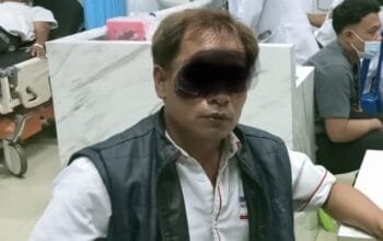 Diduga Aniaya Wartawan, Pemborong Proyek Konblok di Pagaralam Dilaporkan ke Polisi